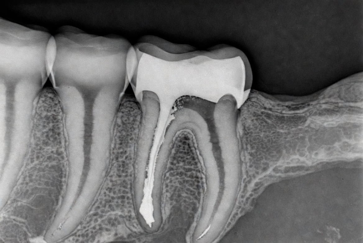 Endodontia 2