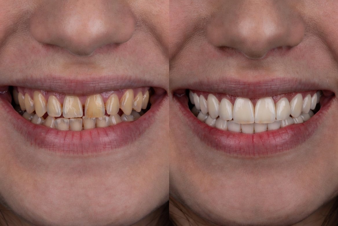Estética Dental 3