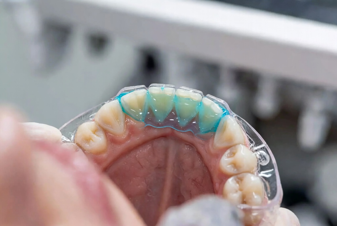 Estética Dental 1