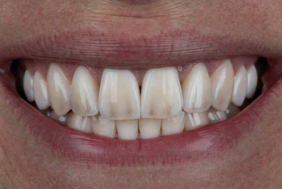 Estética Dental 2
